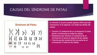 CAUSAS DEL SÍNDROME DE PATAU
La trisomía 13 ocurre cuando aparece ADN extra del
cromosoma 13 en algunas o en todas las células del
cuerpo.
 Trisomía 13: presencia de un cromosoma 13 extra
(tercer cromosoma) en todas las células.
 Mosaicismo por trisomía 13: presencia de un
cromosoma 13 extra en algunas de las células.
 Trisomía parcial: presencia de una parte de un
cromosoma 13 extra en las células.
 