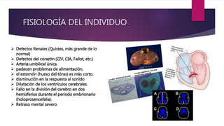 FISIOLOGÍA DEL INDIVIDUO
 Defectos Renales (Quistes, más grande de lo
normal)
 Defectos del corazón (CIV, CIA, Fallot, etc.)
 Arteria umbilical única.
 padecen problemas de alimentación.
 el esternón (hueso del tórax) es más corto.
 disminución en la respuesta al sonido
 Dilatación de los ventrículos cerebrales.
 Fallo en la división del cerebro en dos
hemisferios durante el periodo embrionario
(holoprosencefalia).
 Retraso mental severo.
 