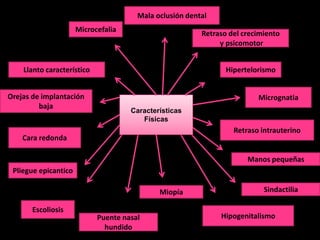 Mala oclusión dental
                      Microcefalia
                                                         Retraso del crecimiento
                                                              y psicomotor


    Llanto característico                                       Hipertelorismo


Orejas de implantación                                                   Micrognatia
         baja
                                     Características
                                        Físicas
                                                                  Retraso intrauterino
    Cara redonda

                                                                      Manos pequeñas
 Pliegue epicantico

                                             Miopía                        Sindactilia

       Escoliosis
                            Puente nasal                      Hipogenitalismo
                              hundido
 