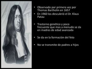 • Observado por primera vez por
  Thomas Bartholin en 1657
• En 1960 los descubrió el Dr. Klaus
  Patau

• Trastorno genético y poco
  frecuente que mas a menudo se da
  en madres de edad avanzada

• Se da en la formación del feto

• No se transmite de padres a hijos
 