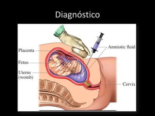 Diagnóstico
 