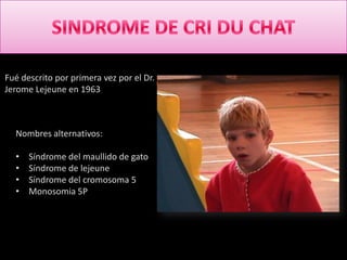 Fué descrito por primera vez por el Dr.
Jerome Lejeune en 1963



  Nombres alternativos:

  •   Síndrome del maullido de gato
  •   Síndrome de lejeune
  •   Síndrome del cromosoma 5
  •   Monosomia 5P
 