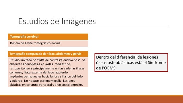 cadenas iliacas comunes s 237 ndrome de poems jos 233 leonis cadenas iliacas comunes s 237 ndrome de poems jos 233 leonis