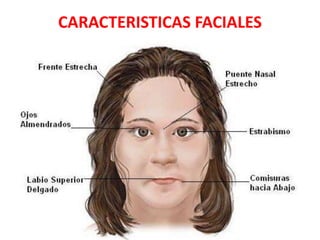 CARACTERISTICAS FACIALES
 