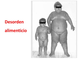 Desorden
alimenticio
 