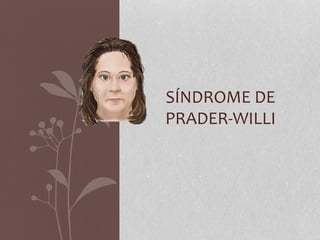 SÍNDROME DE
PRADER-WILLI
 