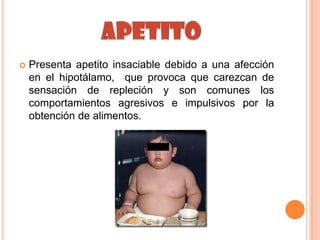    Presenta apetito insaciable debido a una afección
    en el hipotálamo, que provoca que carezcan de
    sensación de repleción y son comunes los
    comportamientos agresivos e impulsivos por la
    obtención de alimentos.
 