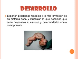    Exponen problemas respecto a la mal formación de
    su sistema óseo y muscular, lo que ocasiona que
    sean propensos a lesiones y enfermedades como
    osteoporosis.
 