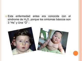   Esta enfermedad antes era conocida con el
    síndrome de H3O, porque los síntomas básicos son
    3 “Hs” y Una “O” :
 
