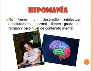  No   tienen un desarrollo intelectual
 absolutamente normal, tienen grado de
 retraso y bajo nivel de contenido mental.
 