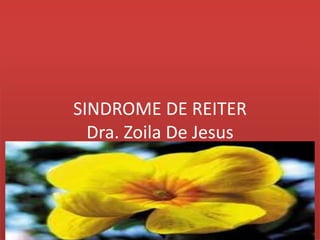 SINDROME DE REITER
  Dra. Zoila De Jesus
 
