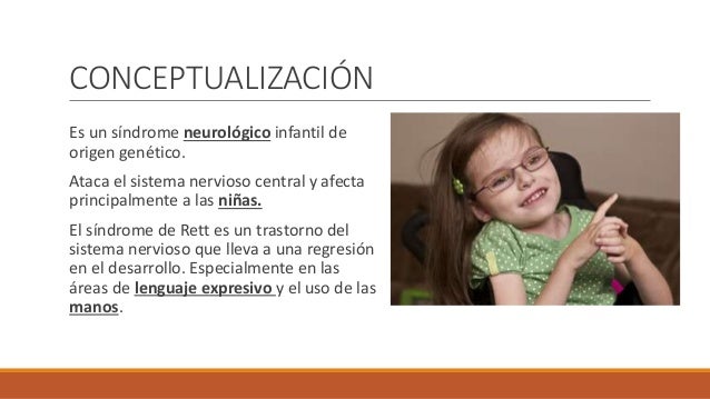 Sindrome de rett