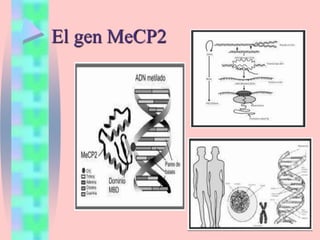 El gen MeCP2
 