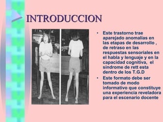 INTRODUCCION
• Este trastorno trae
aparejado anomalías en
las etapas de desarrollo ,
de retraso en las
respuestas sensoriales en
el habla y lenguaje y en la
capacidad cognitiva, el
síndrome de rett esta
dentro de los T.G.D
• Este formato debe ser
tomado de modo
informativo que constituye
una experiencia reveladora
para el escenario docente
 