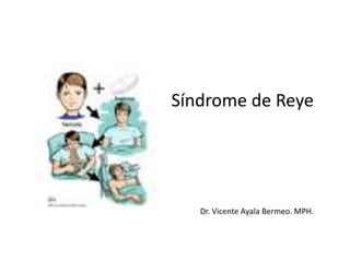 Síndrome de ReyeDr. Vicente Ayala Bermeo. MPH. 