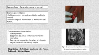 SINDROME DE ROKITANSKY.pptx