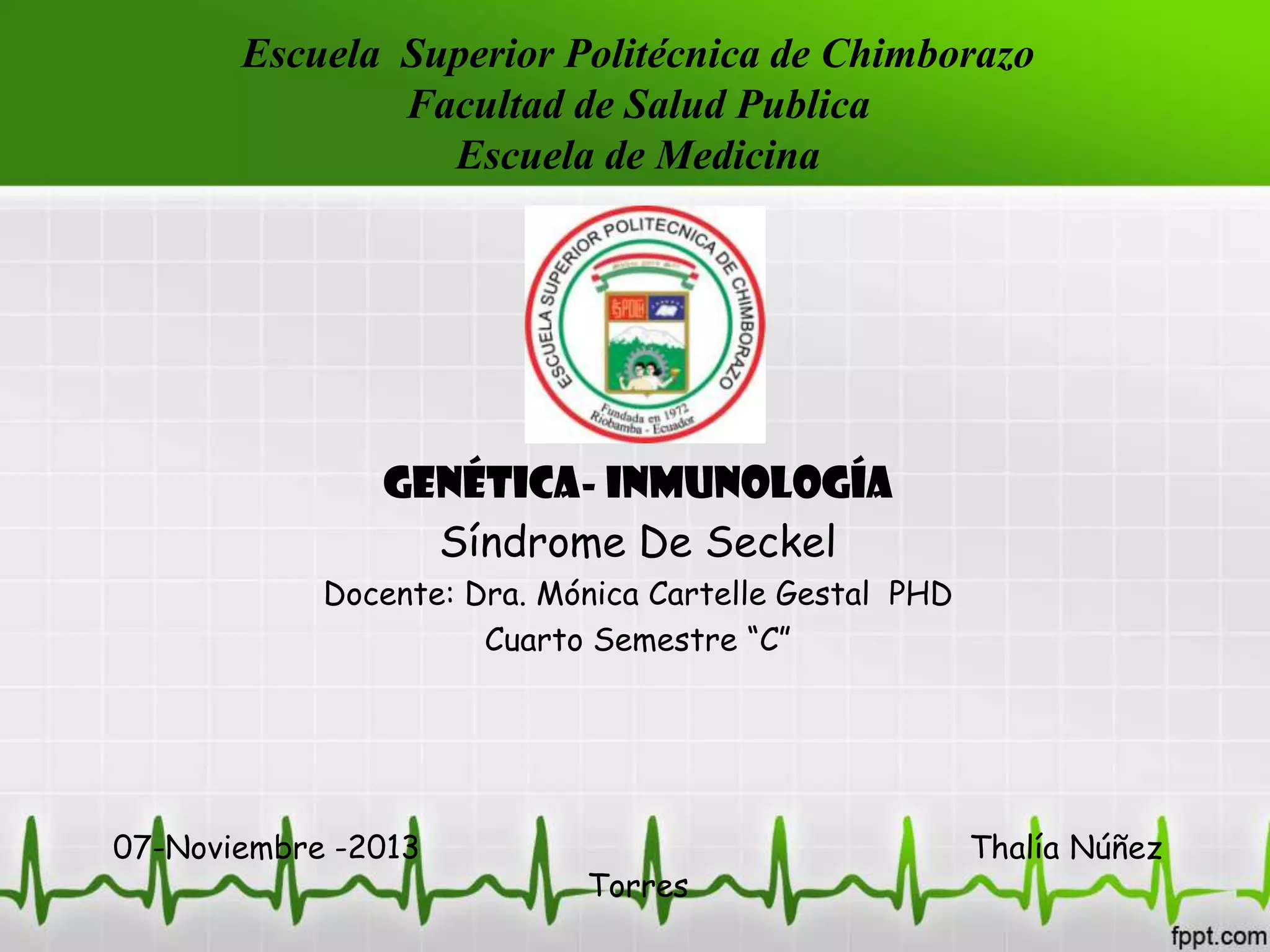Sindrome de seckel thalia | PPTX