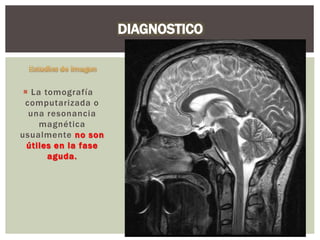  La tomografía
computarizada o
una resonancia
magnética
usualmente no son
útiles en la fase
aguda.
 