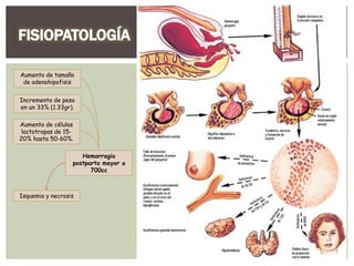 Aumento de tamaño
de adenohipofisis
Incremento de peso
en un 33% (1.33gr).
Aumento de células
lactotropas de 15-
20% hasta 50-60%.
Hemorragia
postparto mayor a
700cc
Isquemia y necrosis
 