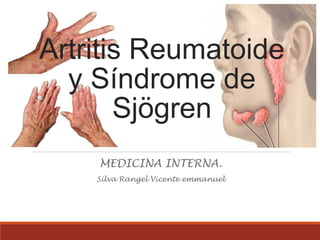 Artritis Reumatoide
y Síndrome de
Sjögren
MEDICINA INTERNA.
Silva Rangel Vicente emmanuel
 