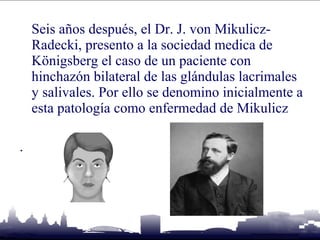 Sindrome de sjogren | PPT