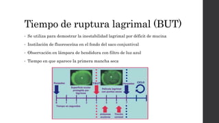 Tiempo de ruptura lagrimal (BUT)
• Se utiliza para demostrar la inestabilidad lagrimal por déficit de mucina
• Instilación de fluoresceína en el fondo del saco conjuntival
• Observación en lámpara de hendidura con filtro de luz azul
• Tiempo en que aparece la primera mancha seca
 