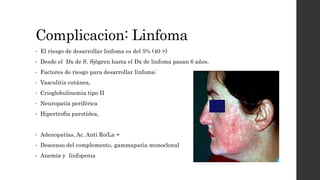 Complicacion: Linfoma
• El riesgo de desarrollar linfoma es del 5% (40 >)
• Desde el Dx de S. Sjögren hasta el Dx de linfoma pasan 6 años.
• Factores de riesgo para desarrollar linfoma:
• Vasculitis cutánea,
• Crioglobulinemia tipo II
• Neuropatía periférica
• Hipertrofia parotídea,
• Adenopatías, Ac. Anti Ro/La +
• Descenso del complemento, gammapatía monoclonal
• Anemia y linfopenia
 