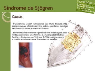   Síndrome de SjögrenCausas  O Síndrome de Sjögren é uma doença auto-imune de causa ainda desconhecida. As infecções por vírus podem, no entanto, contribuir eventualmente para o seu desenvolvimento.  Existem factores hormonais e genéticos bem estabelecidos, dado o nítido predomínio no sexo feminino e a maior probabilidade de familiares de doentes com Síndrome de Sjögren apresentarem anomalias auto-imunes ou de desenvolverem a doença.