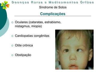 Síndrome de Sotos

                     Complicações

   Oculares (cataratas, estrabismo,
    nistagmus, miopia)


   Cardiopatias congênitas


   Otite crônica

   Obstipação
 