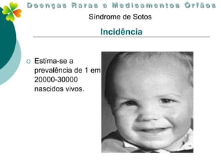 Síndrome de Sotos

                      Incidência


   Estima-se a
    prevalência de 1 em
    20000-30000
    nascidos vivos.
 