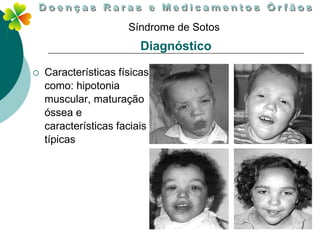 Síndrome de Sotos
                         Diagnóstico

   Características físicas
    como: hipotonia
    muscular, maturação
    óssea e
    características faciais
    típicas
 