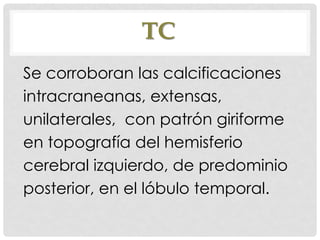 TC
Se corroboran las calcificaciones
intracraneanas, extensas,
unilaterales, con patrón giriforme
en topografía del hemisferio
cerebral izquierdo, de predominio
posterior, en el lóbulo temporal.
 