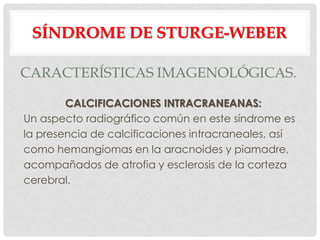 SÍNDROME DE STURGE-WEBER

CARACTERÍSTICAS IMAGENOLÓGICAS.

        CALCIFICACIONES INTRACRANEANAS:
Un aspecto radiográfico común en este síndrome es
la presencia de calcificaciones intracraneales, así
como hemangiomas en la aracnoides y piamadre,
acompañados de atrofia y esclerosis de la corteza
cerebral.
 
