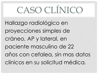 CASO CLÍNICO
Hallazgo radiológico en
proyecciones simples de
cráneo, AP y lateral, en
paciente masculino de 22
años con cefalea, sin mas datos
clínicos en su solicitud médica.
 