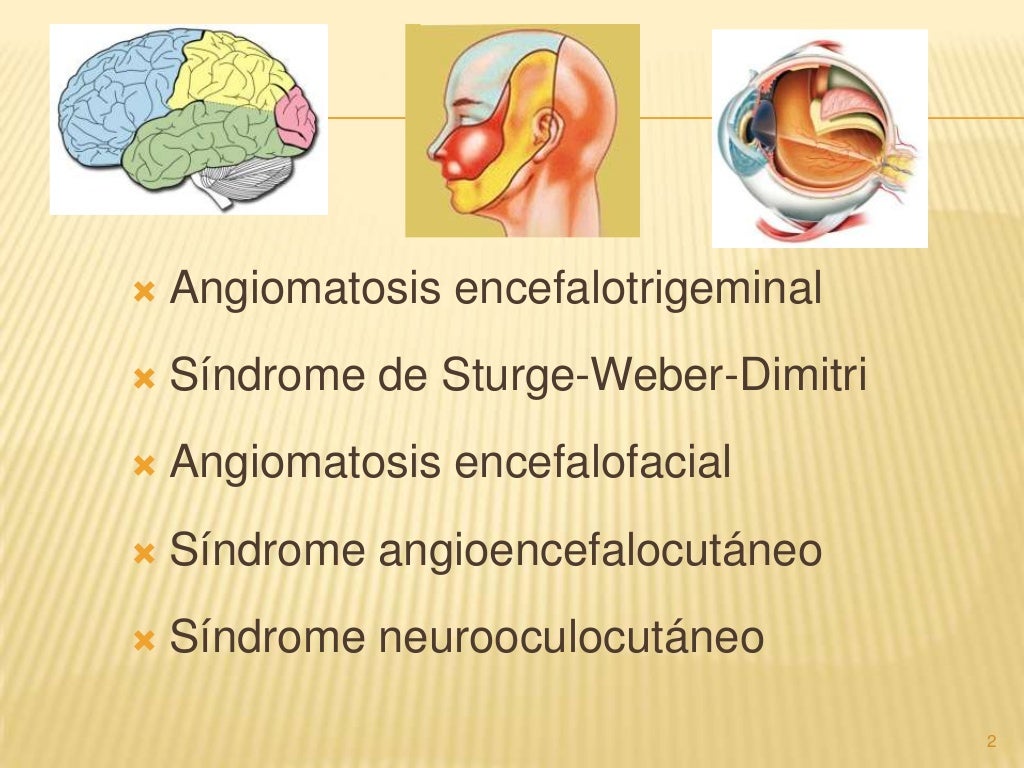 Sindrome de Sturge Weber Sindrome de Sturge Weber