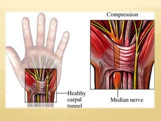 Trabajo en ambiente con temperatura muy fría.