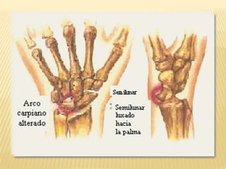 Auto manejo de sillas de ruedas.