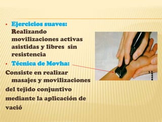 Diagnostico clínicoSigno de Tinel:en donde se percute el ligamento anular de la muñeca con un martillo de reflejos, para determinar si  existe compromiso del canal carpiano. ya que las percusiones   producen una sensación de calambre sobre los dedos segundo y tercero.Signo de Phallen:se realiza una  flexión palmar de la muñeca en 90 grados durante un minuto, lo cual  reduce el espacio del túnel carpiano, desencadenando parestesias en la distribución del nervio medianoSigno de TinelSigno de Phallen