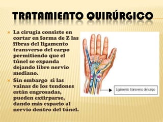 Diagnostico clínicoSigno de Durkan: se  presiona la cara palmar de la muñeca durante unos 30 segundos, lo cual desencadena dolor. Electromiografía:La cual permite  establecer la velocidad de conducción nerviosa del nervio mediano, de tal forma de determinar si existe algún   retardo de la conducción nerviosa sensitiva y motora.Signo de Durkan