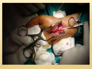 Tratamiento del STC.El tratamiento depende:La edad, estado general de salud y la historia médica. Qué tan avanzada está la enfermedad. Su tolerancia a determinados medicamentos, procedimientos o terapias. 