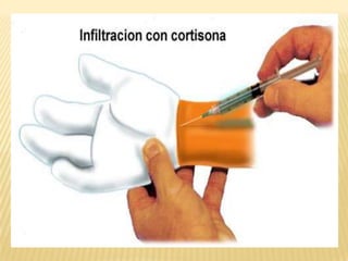 Tratamiento quirúrgico La cirugía consiste en cortar en forma de Z las fibras del ligamento transverso del carpo permitiendo que el túnel se expanda dejando libre nervio mediano.Sin embargo  si las vainas de los tendones están engrosadas, pueden extirparse, dando más espacio al nervio dentro del túnel.