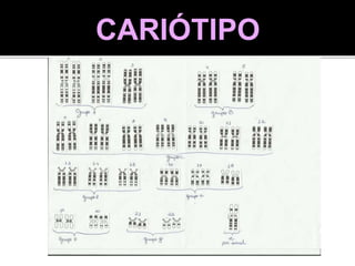 CARIÓTIPO
 