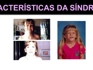 ACTERÍSTICAS DA SÍNDR
 