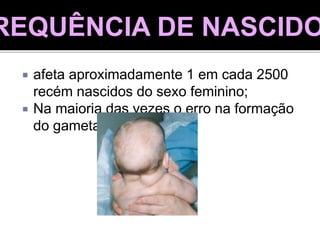  afeta aproximadamente 1 em cada 2500
recém nascidos do sexo feminino;
 Na maioria das vezes o erro na formação
do gameta é paterno.
REQUÊNCIA DE NASCIDO
 