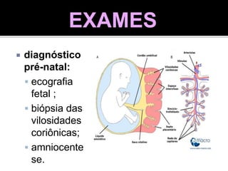  diagnóstico
pré-natal:
 ecografia
fetal ;
 biópsia das
vilosidades
coriônicas;
 amniocente
se.
EXAMES
 