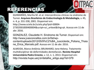 REFERENCIAS
 GUIMARÃES, Marília M. et al. Intercorrências clínicas na síndrome de
Turner. Arquivos Brasileiros de Endocrinologia & Metabologia, v. 45,
n. 4, p. 331-338, 2001. Disponivel em:
http://www.scielo.br/scielo.php?pid=S0004-
27302001000400004&script=sci_arttext&tlng=pt. Acesso em 11 de
abr. 2016.
 GONZALEZ, Claudette H. Síndrome de Turner. Disponivel em:
http://www.jvasconcellos.com.br/fat/wp-
content/uploads/2012/05/9%C2%BA_Juscicleide_Poliana_Thaia
ne_Erica_Marcelo.pdf. Acesso em 11 de abr. 2016.
 ALMEIDA, Marco Antônio; BRUNHARO, Ione Helena. Tratamento
multidisciplinar de deformidades dentofaciais. Revista Hospital
Universitário Pedro Ernesto, v. 12, n. 1, 2013. Disponível em:
http://revista.hupe.uerj.br/detalhe_artigo.asp?id=379
 
