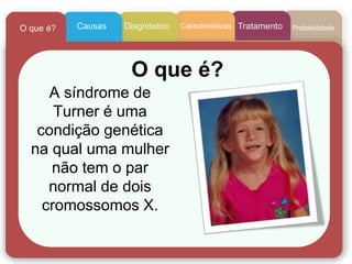 CaracteristicasCausasO que é? Diagnóstico Tratamento Probabilidade
A síndrome de
Turner é uma
condição genética
na qual uma mulher
não tem o par
normal de dois
cromossomos X.
O que é?
 