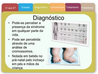 Diagnóstico
• Pode-se perceber a
presença da síndrome
em qualquer parte da
vida.
• Pode ser percebida
através de uma
análise de
cromossomos.
• Notada em bebês no
pré-natal pelo inchaço
em pés e mãos da
criança.
CaracteristicasCausasO que é? Diagnóstico Tratamento Probabilidade
 