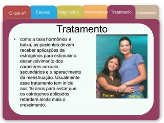 • como a taxa hormônios é
baixa, as pacientes devem
receber aplicações de
estrógenos para estimular o
desenvolvimento dos
caracteres sexuais
secundários e o aparecimento
da menstruação. Usualmente
esse tratamento tem início
aos 16 anos para evitar que
os estrógenos aplicados
retardem ainda mais o
crescimento.
Tratamento
CaracteristicasCausasO que é? Diagnóstico Tratamento Probabilidade
 