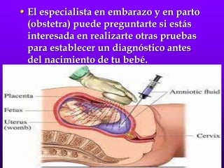 • El especialista en embarazo y en parto
(obstetra) puede preguntarte si estás
interesada en realizarte otras pruebas
para establecer un diagnóstico antes
del nacimiento de tu bebé.
 